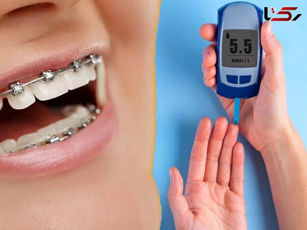  آیا افراد دیابتی می توانند ارتودنسی دندان انجام دهند؟ 