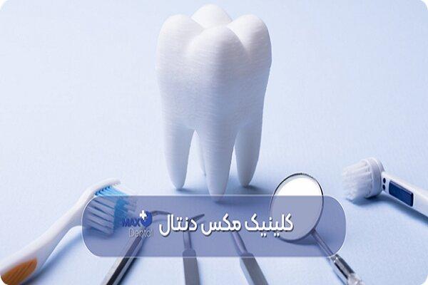 بررسی هزینه‌های دندان پزشکی در تهران(ویژه خدمات زیبایی دندان سال ۱۴۰۴)