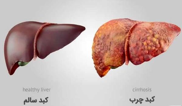   پایان کبد چرب/ قدرت شگفت‌انگیز انتخاب‌های روزمره شما! 