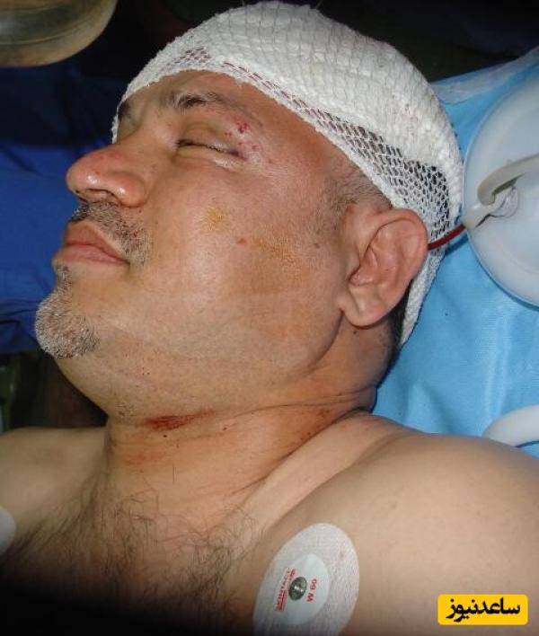 علی دایی روی تخت بیمارستان ؛ از سر شکسته و باند پیچی شده تا حضور عادل فردوسی پور و احمدرضا عابدزاده