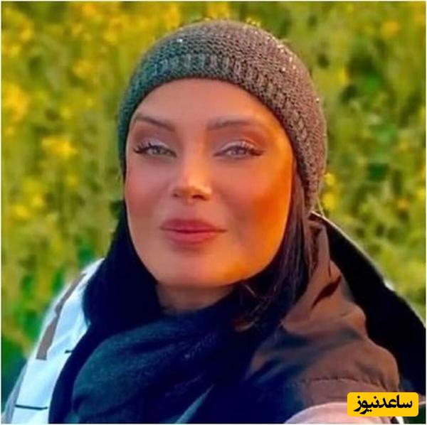 تغییر چهره باورنکردنی صبا راد که بعد دیدنش شوکه میشید/ چرا با خودش اینکارارو میکنه آخه؟