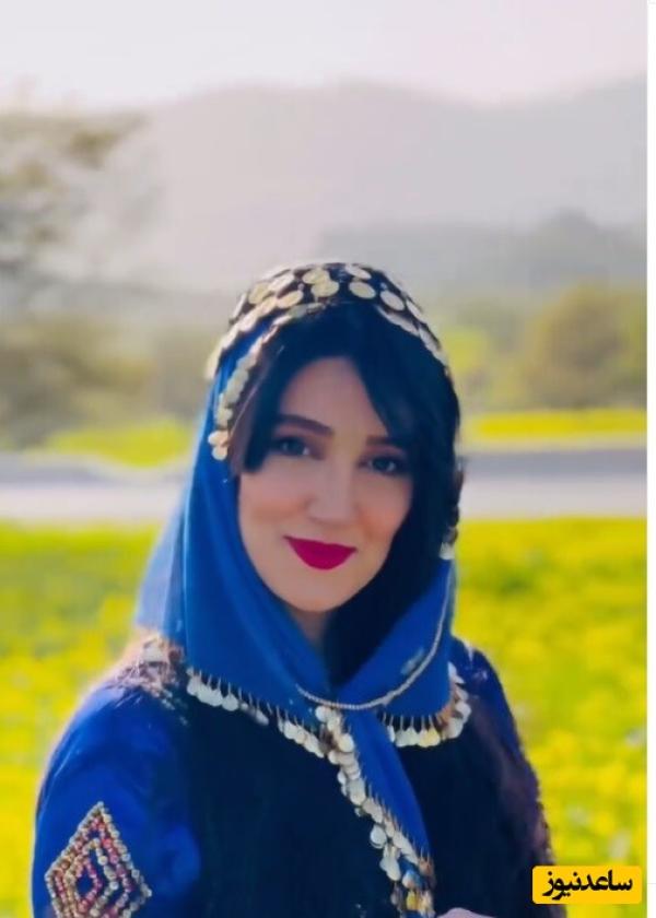 نگاهی به عمل‌های زیبایی زهرا نادری‌فر، هوژان سریال ناریا از زبان خودش