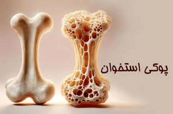   وقتی استخوان‌ها پوک می‌شوند 