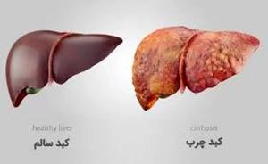   پشت پرده ارتباط مرگبار دیابت و کبد چرب/ دارویی که هر دو را مهار می‌کند! 